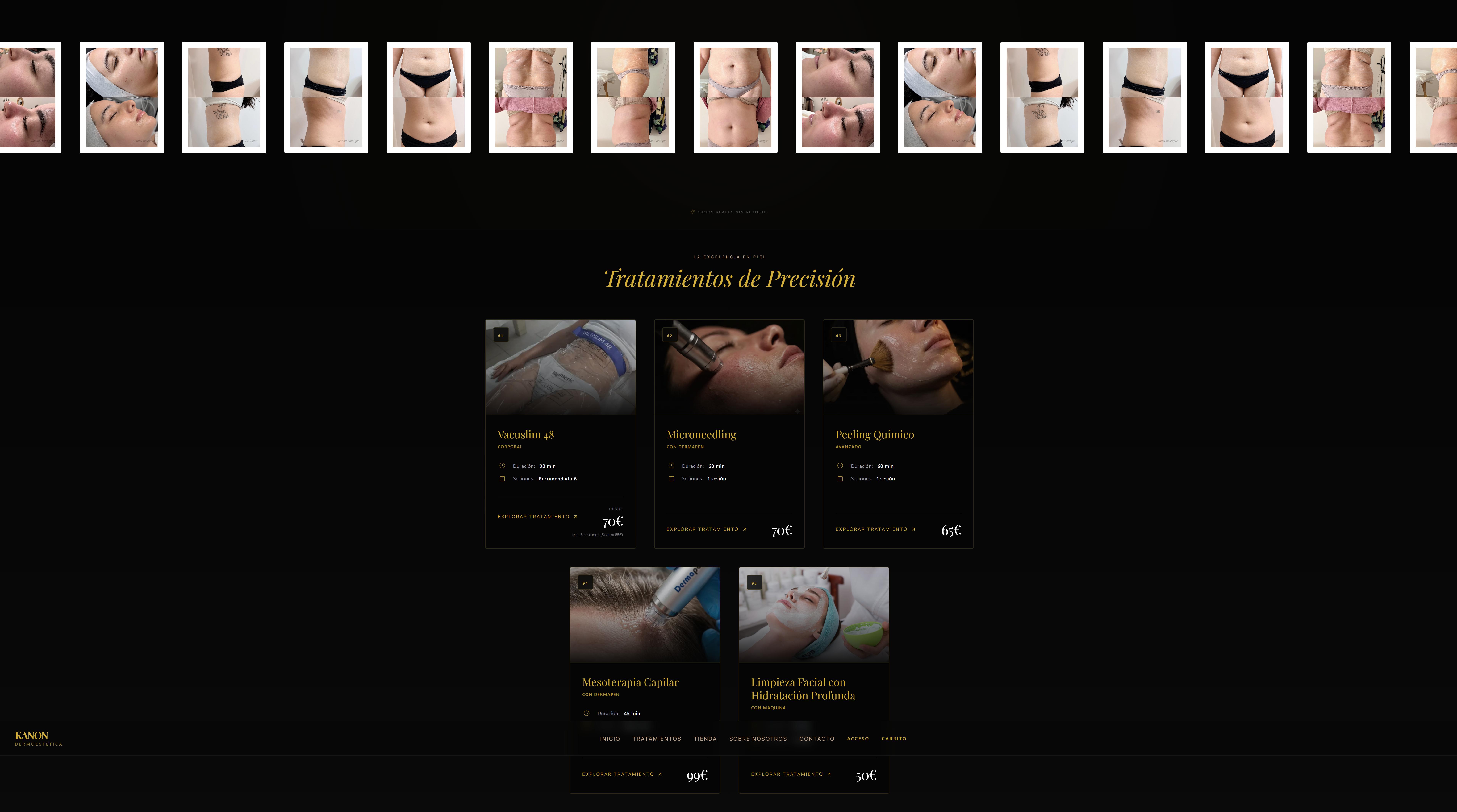 Kanon Dermoestética – Tratamientos de Precisión